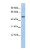 WD repeat, SAM and U-box domain-containing protein 1 antibody, NBP1-55073, Novus Biologicals, Western Blot image 