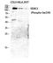 Histone Deacetylase 5 antibody, A01230S259, Boster Biological Technology, Western Blot image 