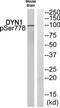 Dynamin 1 antibody, TA313758, Origene, Western Blot image 