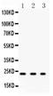 Glutathione S-Transferase Pi 1 antibody, PA1590, Boster Biological Technology, Western Blot image 