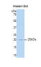 Interleukin 3 Receptor Subunit Alpha antibody, LS-C294902, Lifespan Biosciences, Western Blot image 