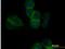 Cadherin 11 antibody, H00001009-M05-100ug, Novus Biologicals, Immunocytochemistry image 