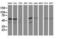 Katanin Catalytic Subunit A1 Like 1 antibody, NBP2-03555, Novus Biologicals, Western Blot image 