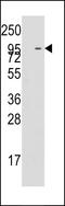Growth Differentiation Factor 15 antibody, 62-804, ProSci, Western Blot image 