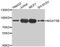 Alpha-1,6-Mannosylglycoprotein 6-Beta-N-Acetylglucosaminyltransferase B antibody, MBS129180, MyBioSource, Western Blot image 