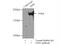 Zinc finger E-box-binding homeobox 1 antibody, 21544-1-AP, Proteintech Group, Immunoprecipitation image 