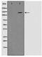 Protein Tyrosine Kinase 2 Beta antibody, TA348419, Origene, Western Blot image 