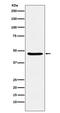 D(3) dopamine receptor antibody, M01277, Boster Biological Technology, Western Blot image 