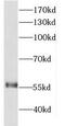 DEAD-Box Helicase 19B antibody, FNab02297, FineTest, Western Blot image 