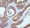 Cadherin 1 antibody, M00063-2, Boster Biological Technology, Immunohistochemistry paraffin image 