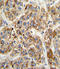 Methylcrotonoyl-CoA Carboxylase 2 antibody, LS-C164081, Lifespan Biosciences, Immunohistochemistry paraffin image 