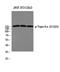 DNA Topoisomerase II Alpha antibody, A00953S1525, Boster Biological Technology, Western Blot image 