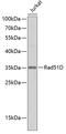 RAD51 Paralog D antibody, GTX64591, GeneTex, Western Blot image 