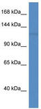 Patatin Like Phospholipase Domain Containing 6 antibody, TA341857, Origene, Western Blot image 