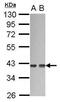 G Protein Subunit Alpha 12 antibody, PA5-29928, Invitrogen Antibodies, Western Blot image 