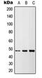 TNF Receptor Superfamily Member 10b antibody, orb215535, Biorbyt, Western Blot image 