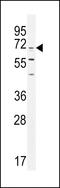 Integrator Complex Subunit 11 antibody, 55-677, ProSci, Western Blot image 