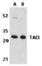 Tumor necrosis factor receptor superfamily member 13B antibody, MBS151456, MyBioSource, Western Blot image 