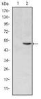 Methylenetetrahydrofolate Reductase antibody, NBP2-37607, Novus Biologicals, Western Blot image 