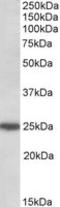 Rho GDP Dissociation Inhibitor Gamma antibody, LS-B8339, Lifespan Biosciences, Western Blot image 