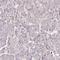 CD47 Molecule antibody, NBP2-32031, Novus Biologicals, Immunohistochemistry paraffin image 