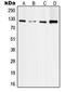 Protein Tyrosine Kinase 2 antibody, LS-C352765, Lifespan Biosciences, Western Blot image 