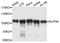 Nucleoporin 98 antibody, LS-C330990, Lifespan Biosciences, Western Blot image 