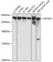 Spectrin alpha chain, brain antibody, GTX66033, GeneTex, Western Blot image 