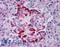 EPH Receptor A2 antibody, LS-B1794, Lifespan Biosciences, Immunohistochemistry frozen image 