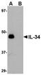 Interleukin-34 antibody, orb75052, Biorbyt, Western Blot image 