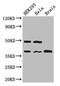 Protein Phosphatase 1 Catalytic Subunit Gamma antibody, A63202-100, Epigentek, Western Blot image 