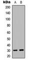 Eukaryotic Translation Initiation Factor 3 Subunit K antibody, LS-C358475, Lifespan Biosciences, Western Blot image 