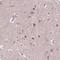 Immunoglobulin Superfamily Containing Leucine Rich Repeat 2 antibody, HPA067333, Atlas Antibodies, Immunohistochemistry paraffin image 