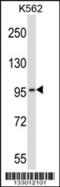 Rod cGMP-specific 3 ,5 -cyclic phosphodiesterase subunit alpha antibody, 56-928, ProSci, Western Blot image 