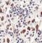 Baculoviral IAP Repeat Containing 5 antibody, MA5-15077, Invitrogen Antibodies, Immunohistochemistry paraffin image 