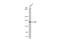 GLI Family Zinc Finger 1 antibody, GTX635705, GeneTex, Western Blot image 