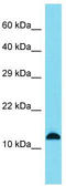 SPANX Family Member B1 antibody, TA343053, Origene, Western Blot image 