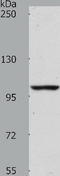 ADAM Metallopeptidase With Thrombospondin Type 1 Motif 17 antibody, TA322061, Origene, Western Blot image 