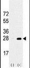 Proteasome Subunit Alpha 5 antibody, PA5-11510, Invitrogen Antibodies, Western Blot image 