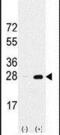 Proteasome Subunit Alpha 5 antibody, PA5-11510, Invitrogen Antibodies, Western Blot image 