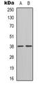 Inhibin Subunit Beta E antibody, orb339146, Biorbyt, Western Blot image 