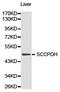 Saccharopine Dehydrogenase (Putative) antibody, LS-C192967, Lifespan Biosciences, Western Blot image 
