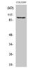 EPH Receptor A1 antibody, STJ92938, St John