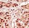 TP53 Regulating Kinase antibody, LS-C101199, Lifespan Biosciences, Immunohistochemistry frozen image 