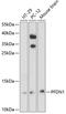 Prefoldin Subunit 1 antibody, 23-702, ProSci, Western Blot image 