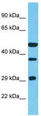 Tetratricopeptide Repeat Domain 23 antibody, TA330802, Origene, Western Blot image 