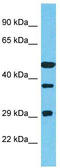 Tetratricopeptide Repeat Domain 23 antibody, TA330802, Origene, Western Blot image 