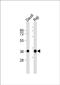 HLA class II histocompatibility antigen, DQ alpha 1 chain antibody, PA5-49452, Invitrogen Antibodies, Western Blot image 