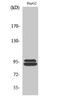 Microtubule-associated serine/threonine-protein kinase-like antibody, GTX34073, GeneTex, Western Blot image 