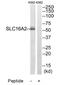 Solute Carrier Family 16 Member 2 antibody, TA314548, Origene, Western Blot image 